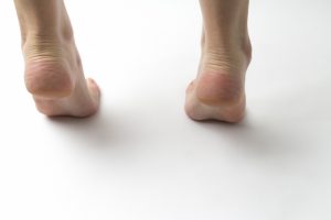 足底腱膜炎のイメージ
