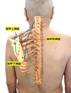 肩甲骨内側の痛みの原因のイメージ