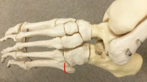 足部の骨模型