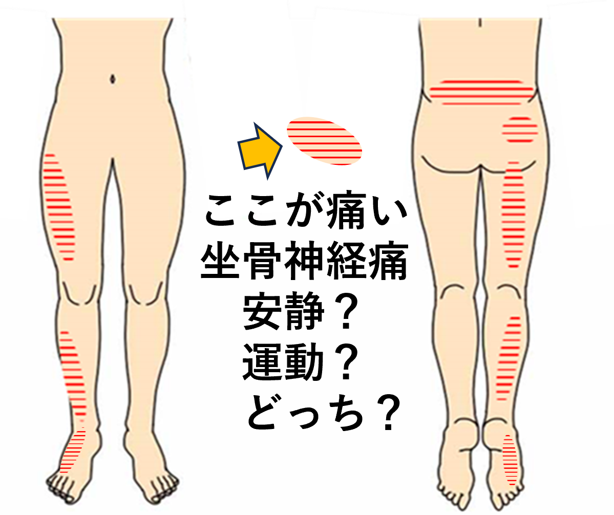 坐骨神経痛は動いた方が良い？【大阪 平野区 加美北 衣摺 生野区 南巽 