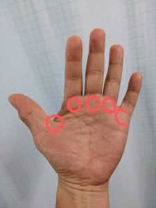 ばね指の好発部位の図